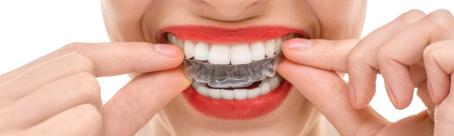 images/banner-orthodontic-treatments.jpg