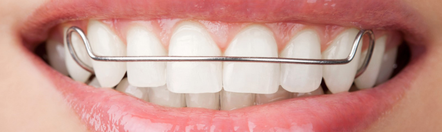 images/banner-retainers.jpg